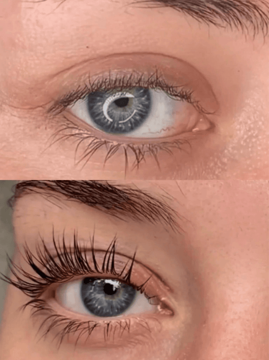 Siero Ciglia - SuperLash